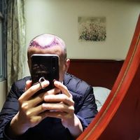 發(fā)際線用戶圖片