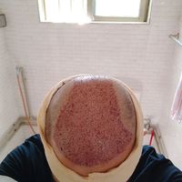 禿頂用戶圖片