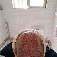 禿頂用戶圖片
