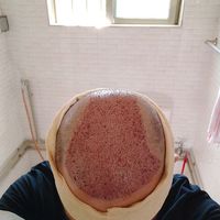 禿頂用戶圖片
