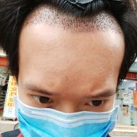 發(fā)際線用戶圖片