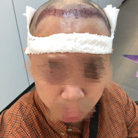 發(fā)際線用戶圖片