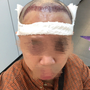 发际线分享社区