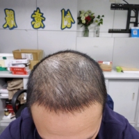 發(fā)際線用戶圖片