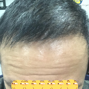 发际线分享社区