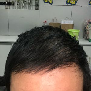 发际线分享社区