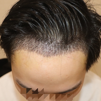 發(fā)際線用戶圖片