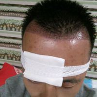發(fā)際線用戶圖片