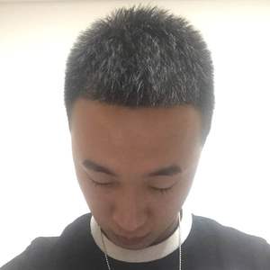 发际线分享社区