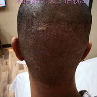 發(fā)際線用戶圖片