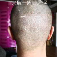 發(fā)際線用戶圖片