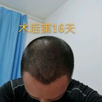 發(fā)際線用戶圖片