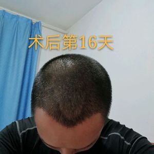 发际线分享社区