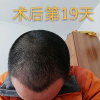 發(fā)際線用戶圖片
