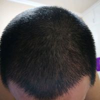 發(fā)際線用戶圖片