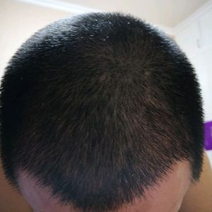 发际线分享社区
