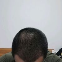 發(fā)際線用戶圖片