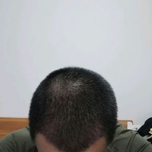 发际线分享社区