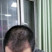 發(fā)際線用戶圖片