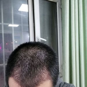 发际线分享社区