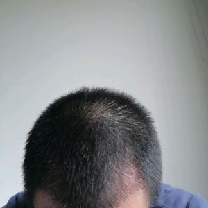 发际线分享社区
