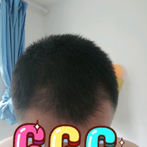 发际线分享社区