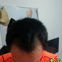 發(fā)際線用戶圖片