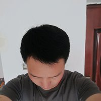 發(fā)際線用戶圖片