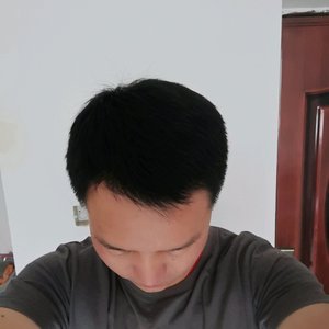 发际线分享社区