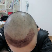 發(fā)際線用戶圖片
