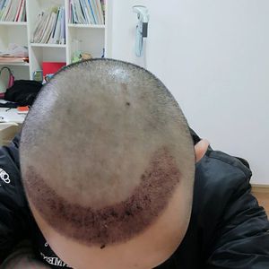 发际线分享社区