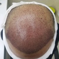發(fā)際線用戶圖片