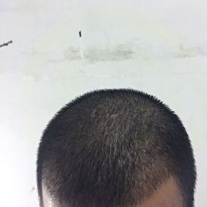 发际线分享社区