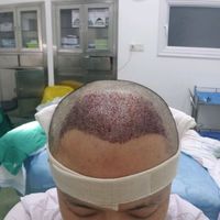 發(fā)際線用戶圖片