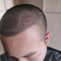 發(fā)際線用戶圖片