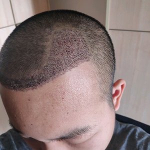 发际线分享社区