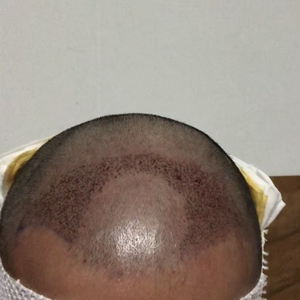 发际线分享社区