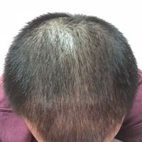 發(fā)際線用戶圖片