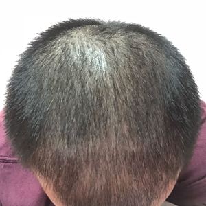 发际线分享社区