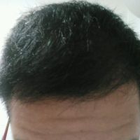 發(fā)際線用戶圖片