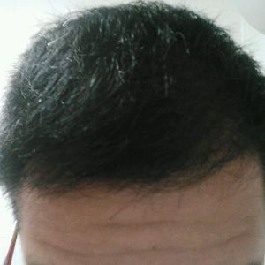发际线分享社区