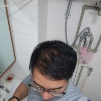 發(fā)際線用戶圖片