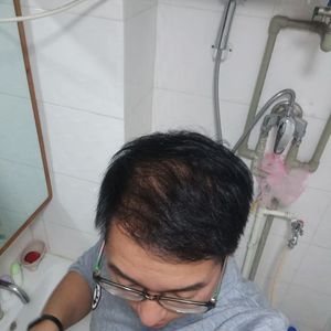发际线分享社区