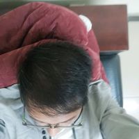發(fā)際線用戶圖片
