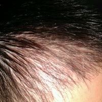 發(fā)際線用戶圖片