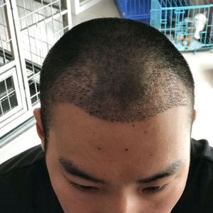 发际线分享社区