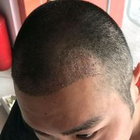 發(fā)際線用戶圖片