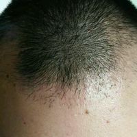 發(fā)際線用戶圖片