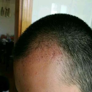 发际线分享社区