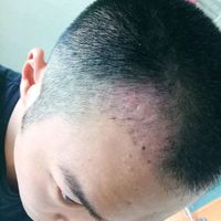 發(fā)際線用戶圖片